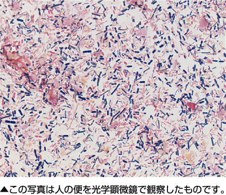 ▲この写真は人の便を光学顕微鏡で観察したものです。